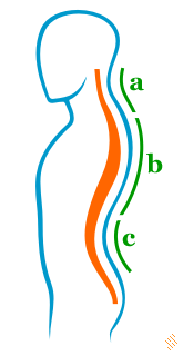 Deviatiile coloanei vertebrale