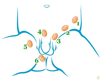 Testicul necoborat - criptorhidie