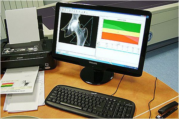 Rezultat electronic test osteodensitometrie