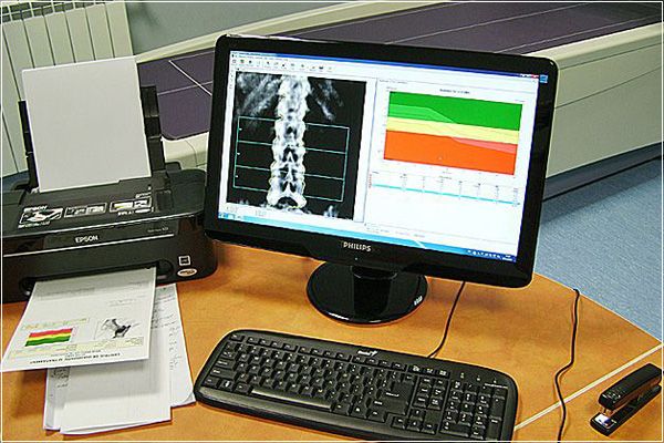 Rezultat electronic test osteodensitometrie